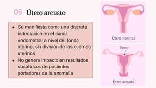 Útero arcuato
● Se manifiesta como una discreta
indentacion en el canal
endometrial a nivel del fondo
uterino, sin división de los cuernos
uterinos
● No genera impacto en resultados
obstétricos de pacientes
portadoras de la anomalia
06
 