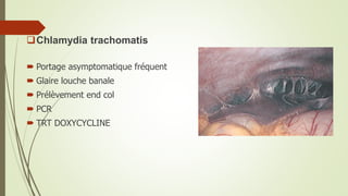 Chlamydia trachomatis
 Portage asymptomatique fréquent
 Glaire louche banale
 Prélèvement end col
 PCR
 TRT DOXYCYCLINE
 