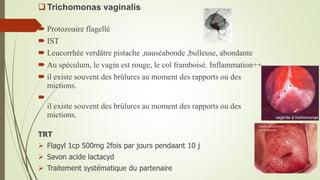Trichomonas vaginalis:
 Protozoaire flagellé
 IST
 Leucorrhée verdâtre pistache ,nauséabonde ,bulleuse, abondante
 Au spéculum, le vagin est rouge, le col framboisé. Inflammation++
 il existe souvent des brûlures au moment des rapports ou des
mictions.

il existe souvent des brûlures au moment des rapports ou des
mictions.
TRT
 Flagyl 1cp 500mg 2fois par jours pendaant 10 j
 Savon acide lactacyd
 Traitement systématique du partenaire
 