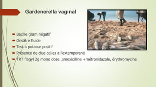 Gardenerella vaginal
 Bacille gram négatif
 Grisâtre fluide
 Test a potasse positif
 Présence de clue celles a l'extemporané
 TRT flagyl 2g mono dose ,amoxicilline +métronidazole, érythromycine
 