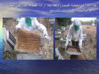 ‫• البدأ في عملية الفحص وهذا بعد ازالة الغطااء الخارجي للخلية‬
                               ‫و ملحظة الطارات بالتدريج‬
 