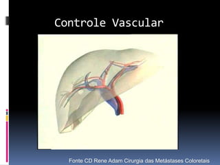 Controle Vascular




  Fonte CD Rene Adam Cirurgia das Metástases Coloretais
 