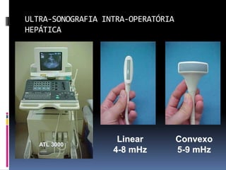 ULTRA-SONOGRAFIA INTRA-OPERATÓRIA
HEPÁTICA




                    Linear          Convexo
   ATL 3000
                   4-8 mHz          5-9 mHz
 