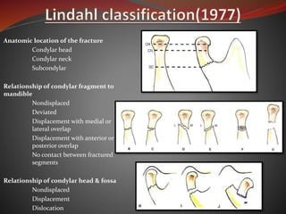Condylar # | PPTX