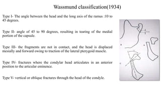 Wassmund classification(1934)
Type I- The angle between the head and the long axis of the ramus :10 to
45 degrees.
Type II- angle of 45 to 90 degrees, resulting in tearing of the medial
portion of the capsule.
Type III- the fragments are not in contact, and the head is displaced
mesially and forward owing to traction of the lateral pterygoid muscle.
Type IV- fractures where the condylar head articulates in an anterior
position to the articular eminence.
Type V- vertical or oblique fractures through the head of the condyle.
 