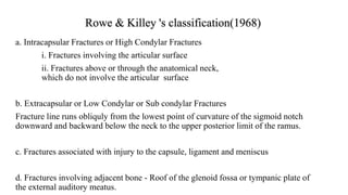 Rowe & Killey 's classification(1968)
a. Intracapsular Fractures or High Condylar Fractures
i. Fractures involving the articular surface
ii. Fractures above or through the anatomical neck,
which do not involve the articular surface
b. Extracapsular or Low Condylar or Sub condylar Fractures
Fracture line runs obliquly from the lowest point of curvature of the sigmoid notch
downward and backward below the neck to the upper posterior limit of the ramus.
c. Fractures associated with injury to the capsule, ligament and meniscus
d. Fractures involving adjacent bone - Roof of the glenoid fossa or tympanic plate of
the external auditory meatus.
 