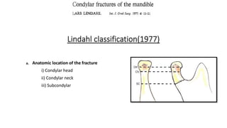 Lindahl classification(1977)
a. Anatomic location of the fracture
i) Condylar head
ii) Condylar neck
iii) Subcondylar
 