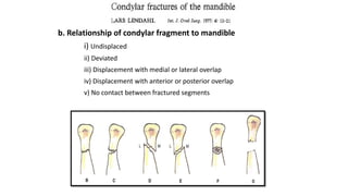 b. Relationship of condylar fragment to mandible
i) Undisplaced
ii) Deviated
iii) Displacement with medial or lateral overlap
iv) Displacement with anterior or posterior overlap
v) No contact between fractured segments
 