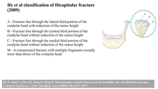 He et al classification of Dicapitular fracture
(2009)
A - Fracture line through the lateral third portion of the
condylar head with reduction of the ramus height
B - Fracture line through the central third portion of the
condylar head without reduction of the ramus height
C - Fracture line through the medial third portion of the
condylar head without reduction of the ramus height
M - A comminuted fracture with multiple fragments (usually
more than three) of the condylar head
He D, Yang C, Chen M, Jiang B, Wang B. Intracapsular condylar fracture of the mandible: our classification and open
treatment experience. J Oral Maxillofac Surg 2009;67(8):1672–1679
 