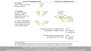 Andreas Neff; The Comprehensive AOCMF Classification System:
Condylar Process Fractures - Level 3 Tutorial; Craniomaxillofacial Trauma and Reconstruction Vol. 7 Suppl. 1/2014
 