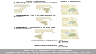Andreas Neff; The Comprehensive AOCMF Classification System:
Condylar Process Fractures - Level 3 Tutorial; Craniomaxillofacial Trauma and Reconstruction Vol. 7 Suppl. 1/2014
 