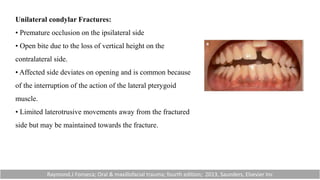 Unilateral condylar Fractures:
• Premature occlusion on the ipsilateral side
• Open bite due to the loss of vertical height on the
contralateral side.
• Affected side deviates on opening and is common because
of the interruption of the action of the lateral pterygoid
muscle.
• Limited laterotrusive movements away from the fractured
side but may be maintained towards the fracture.
Raymond.J Fonseca; Oral & maxillofacial trauma; fourth edition; 2013, Saunders, Elsevier Inc
 