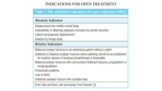 INDICATIONS FOR OPEN TREATMENT
 