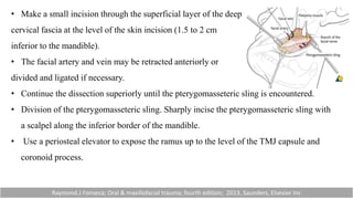 • Make a small incision through the superficial layer of the deep
cervical fascia at the level of the skin incision (1.5 to 2 cm
inferior to the mandible).
• The facial artery and vein may be retracted anteriorly or
divided and ligated if necessary.
• Continue the dissection superiorly until the pterygomasseteric sling is encountered.
• Division of the pterygomasseteric sling. Sharply incise the pterygomasseteric sling with
a scalpel along the inferior border of the mandible.
• Use a periosteal elevator to expose the ramus up to the level of the TMJ capsule and
coronoid process.
Raymond.J Fonseca; Oral & maxillofacial trauma; fourth edition; 2013, Saunders, Elsevier Inc
 