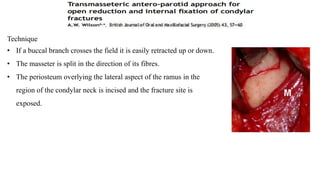 Technique
• If a buccal branch crosses the field it is easily retracted up or down.
• The masseter is split in the direction of its fibres.
• The periosteum overlying the lateral aspect of the ramus in the
region of the condylar neck is incised and the fracture site is
exposed.
 