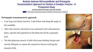 Periangular transmasseteric approach
• 4 cm long curvilinear incision, 5 mm below and along the angle of
the mandible
• After skin incision, dissection was continued in the subcutaneous
plane, upward and superficial to the platysma till the zygomatic
arch.
• The thin platysma muscle is held with tissue holding forceps and
incised obliquely to expose the masseteric fascia overlying the
masseter belly
 