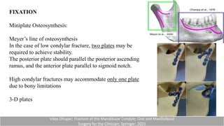 FIXATION
Miniplate Osteosynthesis:
Meyer’s line of osteosynthesis
In the case of low condylar fracture, two plates may be
required to achieve stability.
The posterior plate should parallel the posterior ascending
ramus, and the anterior plate parallel to sigmoid notch.
High condylar fractures may accommodate only one plate
due to bony limitations
3-D plates
Vikas Dhupar; Fracture of the Mandibular Condyle; Oral and Maxillofacial
Surgery for the Clinician; Springer; 2021
 