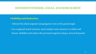OSTEOSYNTHESIS: AXIAL ANCHOR SCREW
Visibility and Reduction.
 Distract the distal segment using ligature wire at the gonial angle.
 Use a sigmoid notch retractor and condylar neck retractor to reflect soft
tissues. Stabilize and reduce the proximal segment using a curved hemostat.
118
 