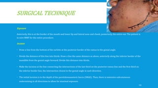 SURGICAL TECHNIQUE
Exposure
Anteriorly, this is at the border of the mouth and lower lip and lateral nose and cheek; posteriorly, the entire ear. The patient is
in wire MMF for the entire procedure.
Incision
 Draw a line from the bottom of the earlobe at the posterior border of the ramus to the gonial angle.
 Divide the distance of this line into thirds. Draw a line the same distance as above, anteriorly along the inferior border of the
mandible from the gonial angle forward. Divide this distance into thirds.
 Make the incision at the line connecting the intersections of the last third on the posterior ramus line and the first third on
the inferior border line, the intersection closest to the gonial angle in each direction .
 The initial incision is to the depth of the parotidomasseteric fascia (SMAS). Then, there is extensive subcutaneous
undermining in all directions to allow for maximal exposure.
135
 