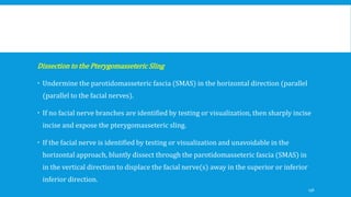 Dissection to the Pterygomasseteric Sling
 Undermine the parotidomasseteric fascia (SMAS) in the horizontal direction (parallel
(parallel to the facial nerves).
 If no facial nerve branches are identified by testing or visualization, then sharply incise
incise and expose the pterygomasseteric sling.
 If the facial nerve is identified by testing or visualization and unavoidable in the
horizontal approach, bluntly dissect through the parotidomasseteric fascia (SMAS) in
in the vertical direction to displace the facial nerve(s) away in the superior or inferior
inferior direction.
136
 