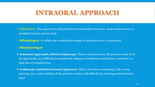 INTRAORAL APPROACH
 Indications. This approach is indicated for low subcondylar fractures. Axial anchor screws or
miniplate fixation may be used.
 Advantages. A visible scar avoided and damage to the facial nerve is minimized.
 Disadvantages
 Intraoral Approach without Endoscope. There is limited access, the poorest access of all
the approaches, it is difficult to ascertain the adequacy of reduction and fixation, and there is a
high rate of complications.
 Endoscope-Assisted Intraoral Approach. This is more time-consuming, with a steep
learning curve, poor visibility of the posterior ramus, and difficulty in reducing certain fracture
types
154
 