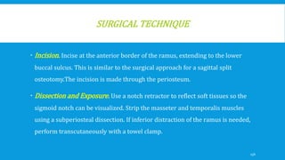 SURGICAL TECHNIQUE
 Incision. Incise at the anterior border of the ramus, extending to the lower
buccal sulcus. This is similar to the surgical approach for a sagittal split
osteotomy.The incision is made through the periosteum.
 Dissection and Exposure. Use a notch retractor to reflect soft tissues so the
sigmoid notch can be visualized. Strip the masseter and temporalis muscles
using a subperiosteal dissection. If inferior distraction of the ramus is needed,
perform transcutaneously with a towel clamp.
156
 