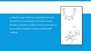 3. Kinetic energy which is a summation of forces
derived from a combination of (1) and (2) and,
therefore, generally produces a more severe type of
injury such as typically occurs in a road traffic
accident.
17
 