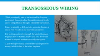 TRANSOSSEOUS WIRING
 This is occasionally used in low subcondylar fractures,
particularly those extending through the sigmoid notch,
access being obtained through a submandibular incision.
 It may be possible to drill and wire across the fracture at
one or even two sites in the conventional manner.
 It is best to pass the wire through the hole in the major
fragment first so that this may be used for a downward
traction to improve access to the condylar fragment.
 A pull-through wire may be needed for passing the wire
through a hole drilled in the minor fragment.
172
 