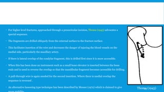  For higher level fractures, approached through a preauricular incision, Thoma (1945) advocates a
special sequence.
 The fragments are drilled obliquely from the external surface to the fracture surface.
 This facilitates insertion of the wire and decreases the danger of injuring the blood vessels on the
medial side, particularly the maxillary artery.
 If there is lateral overlap of the condylar fragment, this is drilled first since it is more accessible.
 When this has been done an instrument such as a small bone elevator is inserted between the bone
ends and is used to reverse the overlap so that the mandibular fragment becomes accessible for drilling.
 A pull-through wire is again needed for the second insertion. Where there is medial overlap the
sequence is reversed .
 An alternative lassooing type technique has been described by Messer (1972) which is claimed to give Thoma (1945)173
 