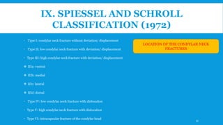 IX. SPIESSEL AND SCHROLL
CLASSIFICATION (1972)
 Type I: condylar neck fracture without deviation/ displacement
 Type II: low condylar neck fracture with deviation/ displacement
 Type III: high condylar neck fracture with deviation/ displacement
 IIIa: ventral
 IIIb: medial
 IIIc: lateral
 IIId: dorsal
 Type IV: low condylar neck fracture with dislocation
 Type V: high condylar neck fracture with dislocation
 Type VI: intracapsular fracture of the condylar head
LOCATION OF THE CONDYLAR NECK
FRACTURES
33
 