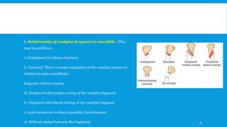 b. Relationship of condylar fragment to mandible : This
may be as follows:
i. Undisplaced (or fissure fracture)
ii. Deviated: This is a simple angulation of the condylar process in
relation to main mandibular
fragment without overlap
iii. Displaced with medial overlap of the condylar fragment
iv. Displaced with lateral overlap of the condylar fragment
v. Anteroposterior overlap is possible, but infrequent
vi. Without contact between the fragments 37
 