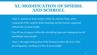 XI. MODIFICATION OF SPIESSL
AND SCHROLL
 Type A: continuous bony contact within the articular fossa, with a
component of the condylar head remaining and the fracture supported
without loss of ramus height
 Type B: loss of support within the articulating fossa and subsequent loss of
mandibular ramus height
 Type C: the uppermost portion of the fracture is below the level of the
lateral ligament, resulting in a loss of ramus height
39
 