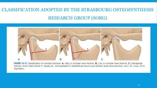 CLASSIFICATION ADOPTED BY THE STRASBOURG OSTEOSYNTHESIS
RESEARCH GROUP (SORG)
42
 