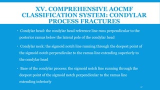 XV. COMPREHENSIVE AOCMF
CLASSIFICATION SYSTEM: CONDYLAR
PROCESS FRACTURES
 Condylar head: the condylar head reference line runs perpendicular to the
posterior ramus below the lateral pole of the condylar head
 Condylar neck: the sigmoid notch line running through the deepest point of
the sigmoid notch perpendicular to the ramus line extending superiorly to
the condylar head
 Base of the condylar process: the sigmoid notch line running through the
deepest point of the sigmoid notch perpendicular to the ramus line
extending inferiorly
47
 
