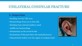 UNILATERAL CONDYLAR FRACTURE
A. Inspection
• Swelling over the TMJ area.
• Heamorrhage from ear on that side.
- bleeding from external auditory canal
- middle ear haemorrhage
• Haematoma on the involved side
• Ecchymosis of skin just below the mastoid process
• Characteristic hollow over the region of condylar head
49
 
