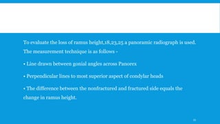 To evaluate the loss of ramus height,18,23,25 a panoramic radiograph is used.
The measurement technique is as follows -
• Line drawn between gonial angles across Panorex
• Perpendicular lines to most superior aspect of condylar heads
• The difference between the nonfractured and fractured side equals the
change in ramus height.
55
 