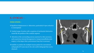 E. CT SCAN –
INDICATIONS –
Significant displacement or dislocation, particularly if open reduction
is contemplated
 Limited range of motion with a suspicion of mechanical obstruction
caused By the position of the condylar segment
 Alteration of the surrounding osseous anatomy by other processes,
such as previous internal derangement or temporomandibular joint
surgery, to the degree that a pretreatment base-line is necessary
Inability to position the multiple-trauma patient for conventional
radiographs (CT scans may be the only useful radiograph that can be
obtained)
64
 