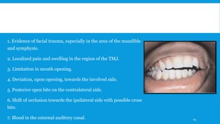 1. Evidence of facial trauma, especially in the area of the mandible
and symphysis.
2. Localized pain and swelling in the region of the TMJ.
3. Limitation in mouth opening.
4. Deviation, upon opening, towards the involved side.
5. Posterior open bite on the contralateral side.
6. Shift of occlusion towards the ipsilateral side with possible cross
bite.
7. Blood in the external auditory canal. 69
 