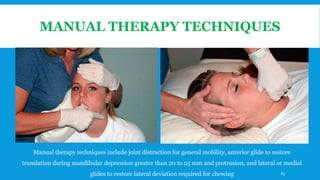MANUAL THERAPY TECHNIQUES
Manual therapy techniques include joint distraction for general mobility, anterior glide to restore
translation during mandibular depression greater than 20 to 25 mm and protrusion, and lateral or medial
glides to restore lateral deviation required for chewing 85
 