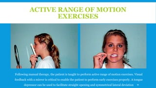 ACTIVE RANGE OF MOTION
EXERCISES
Following manual therapy, the patient is taught to perform active range of motion exercises. Visual
feedback with a mirror is critical to enable the patient to perform early exercises properly. A tongue
depressor can be used to facilitate straight opening and symmetrical lateral deviation 86
 