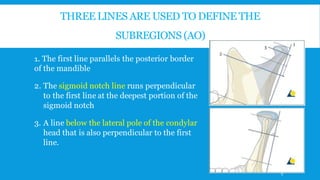 THREE LINES ARE USED TO DEFINE THE
SUBREGIONS (AO)
1. The first line parallels the posterior border
of the mandible
2. The sigmoid notch line runs perpendicular
to the first line at the deepest portion of the
sigmoid notch
3. A line below the lateral pole of the condylar
head that is also perpendicular to the first
line.
9
 