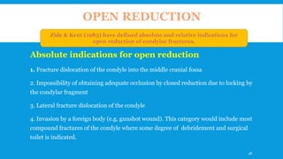 Absolute indications for open reduction
1. Fracture dislocation of the condyle into the middle cranial fossa
2. Impossibility of obtaining adequate occlusion by closed reduction due to locking by
the condylar fragment
3. Lateral fracture dislocation of the condyle
4. Invasion by a foreign body (e.g. gunshot wound). This category would include most
compound fractures of the condyle where some degree of debridement and surgical
toilet is indicated.
OPEN REDUCTION
98
 