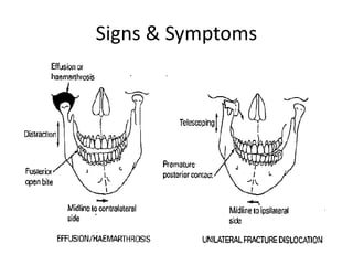 Signs & Symptoms
 