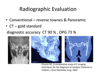 Radiographic Evaluation
• Conventional – reverse townes & Panoramic
• CT – gold standard
diagnostic accuracy CT 90 % , OPG 73 %
Chacon GE, A comparative study of 2 imaging
techniques for the diagnosis of condylar fractures in
children. J Oral Maxillofac Surg. 2003
 