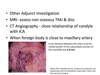 • Other Adjunct investigation
• MRI- assess non osseous TMJ & disc
• CT Angiography - close relationship of condyle
with ICA
• When foreign body is close to maxillary artery
mean distance between the artery and the
medial border of the subcondylar portion of
the mandible was 6.8 mm
Orbay 2007 ,Maxillary Artery: Anatomical Landmarks and
Relationship with the Mandibular Subcondyle. Plastic and
Reconstructive Surgery
 