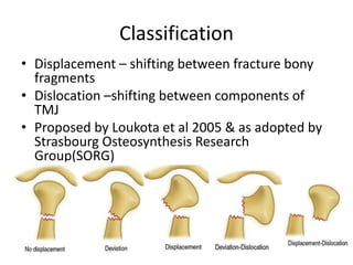 Classification
• Displacement – shifting between fracture bony
fragments
• Dislocation –shifting between components of
TMJ
• Proposed by Loukota et al 2005 & as adopted by
Strasbourg Osteosynthesis Research
Group(SORG)
 