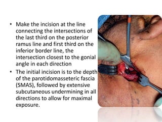 • Make the incision at the line
connecting the intersections of
the last third on the posterior
ramus line and first third on the
inferior border line, the
intersection closest to the gonial
angle in each direction
• The initial incision is to the depth
of the parotidomasseteric fascia
(SMAS), followed by extensive
subcutaneous undermining in all
directions to allow for maximal
exposure.
 