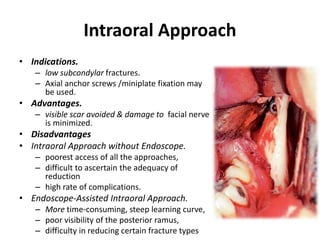 Intraoral Approach
• Indications.
– low subcondylar fractures.
– Axial anchor screws /miniplate fixation may
be used.
• Advantages.
– visible scar avoided & damage to facial nerve
is minimized.
• Disadvantages
• Intraoral Approach without Endoscope.
– poorest access of all the approaches,
– difficult to ascertain the adequacy of
reduction
– high rate of complications.
• Endoscope-Assisted Intraoral Approach.
– More time-consuming, steep learning curve,
– poor visibility of the posterior ramus,
– difficulty in reducing certain fracture types
 