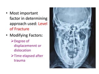 • Most important
factor in determining
approach used: Level
of Fracture
• Modifying Factors:
Degree of
displacemennt or
dislocation
Time elapsed after
trauma
 