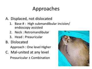 Approaches
A. Displaced, not dislocated
1. Base # : High submandibular incision/
endoscopy assisted
2. Neck : Retromandibular
3. Head : Preauricular
B. Dislocated
Approach : One level Higher
C. Mal-united at any level
Preauricular ± Combination
 